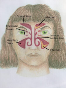 Sinus Diagram